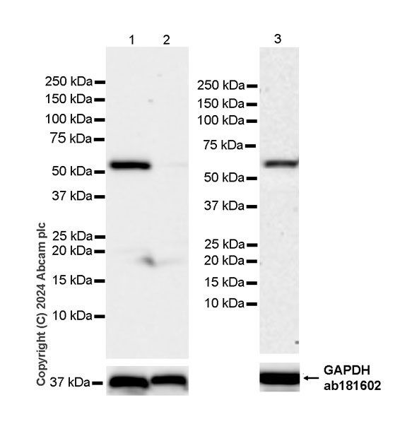 Western blot - Anti-ST2 antibody [EPR28307-82] - BSA and Azide free (AB317558), expandable thumbnail