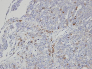Immunohistochemistry (Formalin/PFA-fixed paraffin-embedded sections) - Anti-ST3Gal I antibody (AB96129), expandable thumbnail