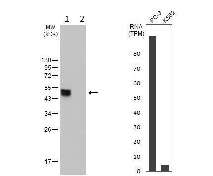 Western blot - Anti-ST3Gal I antibody (AB96129)