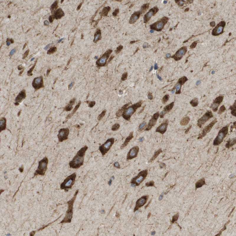 Immunohistochemistry (Formalin/PFA-fixed paraffin-embedded sections) - Anti-ST3GAL2 antibody (AB254726), expandable thumbnail