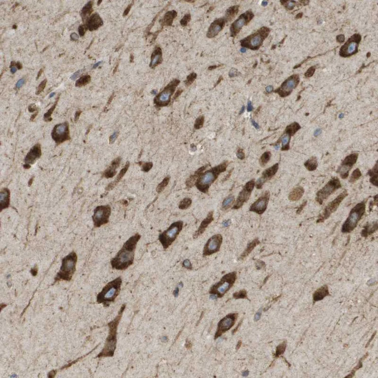 Immunohistochemistry (Formalin/PFA-fixed paraffin-embedded sections) - Anti-ST3GAL2 antibody (AB254726)