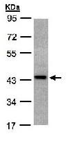 Western blot - Anti-ST3GAL2 antibody (AB96028)