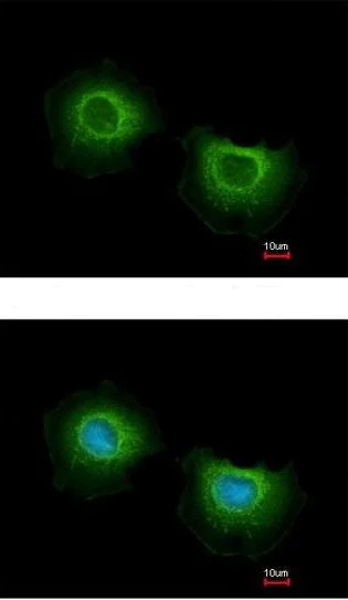 Immunocytochemistry/ Immunofluorescence - Anti-ST3GAL3 antibody (AB155022)