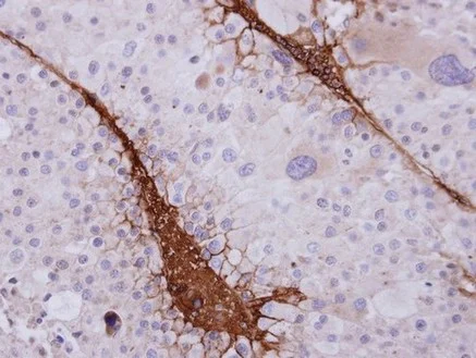 Immunohistochemistry (Formalin/PFA-fixed paraffin-embedded sections) - Anti-ST3GAL3 antibody (AB155022)