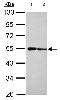 Western blot - Anti-ST3GAL3 antibody (AB155022)