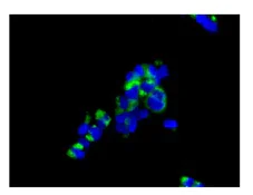 Immunocytochemistry/ Immunofluorescence - Anti-ST3GAL3 antibody [EPR10006(2)] - BSA and Azide free (AB250029)