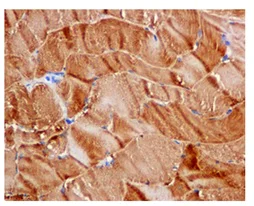 Immunohistochemistry (Formalin/PFA-fixed paraffin-embedded sections) - Anti-ST3GAL3 antibody [EPR10006(2)] - BSA and Azide free (AB250029)