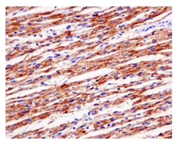 Immunohistochemistry (Formalin/PFA-fixed paraffin-embedded sections) - Anti-ST3GAL3 antibody [EPR10006(2)] - BSA and Azide free (AB250029)
