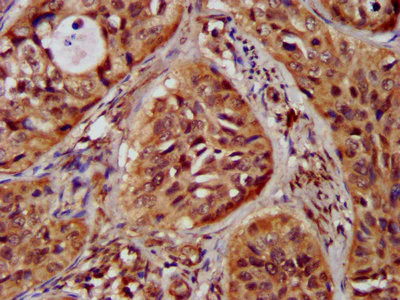 Immunohistochemistry (Formalin/PFA-fixed paraffin-embedded sections) - Anti-ST3GAL4/STZ antibody (AB238742)