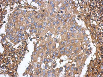 Immunohistochemistry (Formalin/PFA-fixed paraffin-embedded sections) - Anti-ST3GAL5 antibody (AB155671), expandable thumbnail