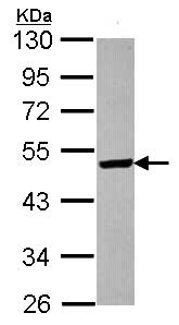 Western blot - Anti-ST3GAL5 antibody (AB155671), expandable thumbnail