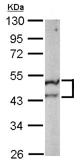 Western blot - Anti-ST3GAL5 antibody (AB155671), expandable thumbnail