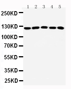 Western blot - Anti-ST5 antibody (AB187759), expandable thumbnail