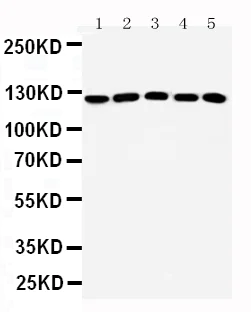 Western blot - Anti-ST5 antibody (AB187759)