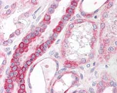 Immunohistochemistry (Formalin/PFA-fixed paraffin-embedded sections) - Anti-ST6GAL1 antibody (AB124407)