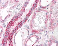 Immunohistochemistry (Formalin/PFA-fixed paraffin-embedded sections) - Anti-ST6GAL1 antibody (AB124407)