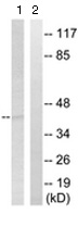 Western blot - Anti-ST6GAL1 antibody (AB124407)