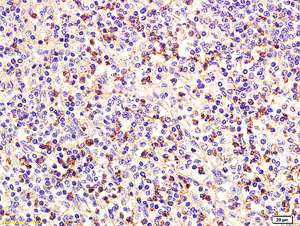 Immunohistochemistry (Formalin/PFA-fixed paraffin-embedded sections) - Anti-ST6GAL1 antibody (AB203304)