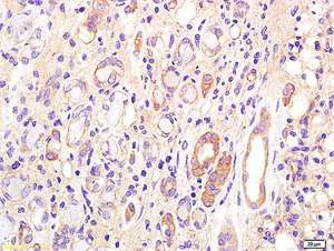 Immunohistochemistry (Formalin/PFA-fixed paraffin-embedded sections) - Anti-ST6GAL1 antibody (AB203304)