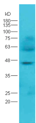 Western blot - Anti-ST6GAL1 antibody (AB203304)