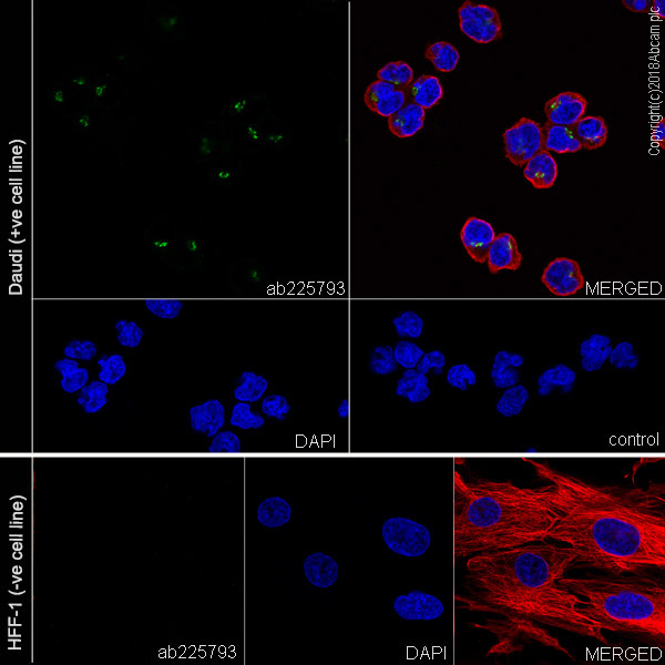 Immunocytochemistry/ Immunofluorescence - Anti-ST6GAL1 antibody [EPR22054-238] (AB225793)