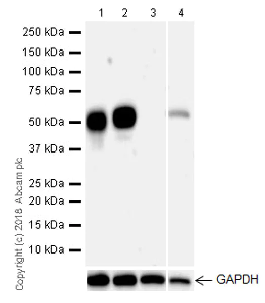 Western blot - Anti-ST6GAL1 antibody [EPR22054-238] (AB225793)