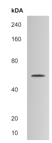 Western blot - Anti-ST6GAL2 antibody (AB214920)