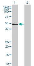 Western blot - Anti-ST6GAL2 antibody (AB69276)