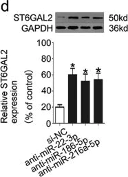 Western blot - Anti-ST6GAL2 antibody (AB69276)