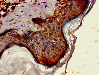 Immunohistochemistry (Formalin/PFA-fixed paraffin-embedded sections) - Anti-ST6GalNAc I antibody (AB229816), expandable thumbnail