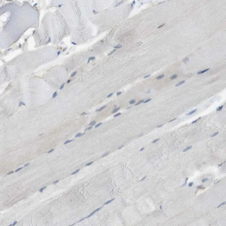 Immunohistochemistry (Formalin/PFA-fixed paraffin-embedded sections) - Anti-ST6GalNAc I antibody (AB272569)