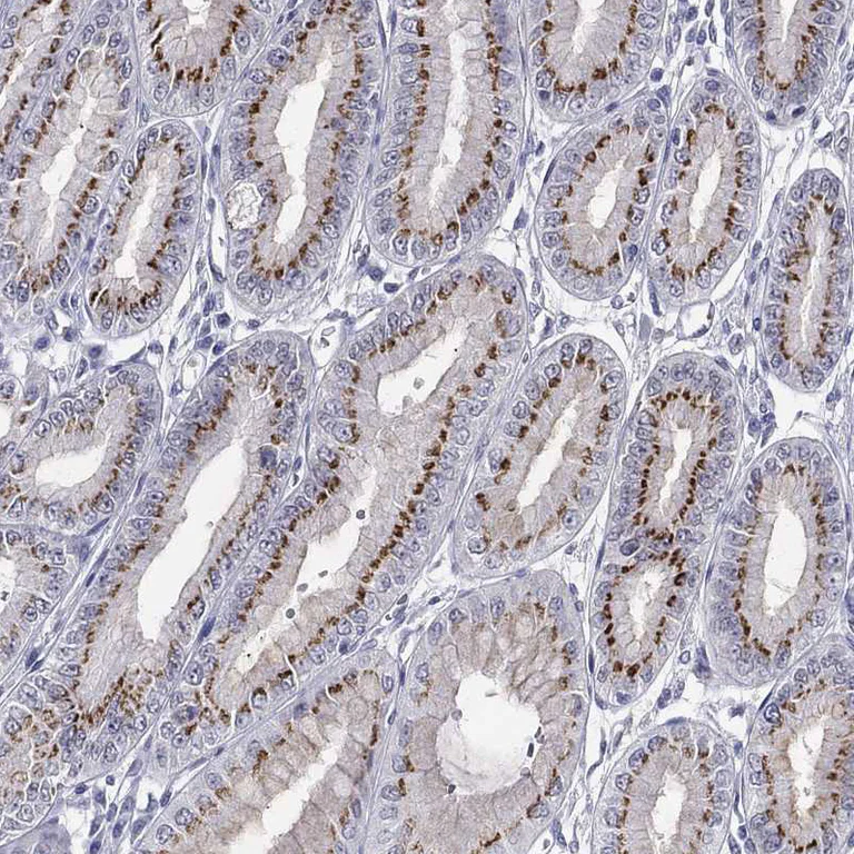 Immunohistochemistry (Formalin/PFA-fixed paraffin-embedded sections) - Anti-ST6GalNAc I antibody (AB272569)