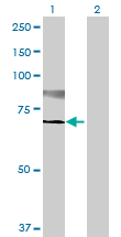 Western blot - Anti-ST6GalNAc I antibody (AB69066)