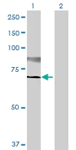 Western blot - Anti-ST6GalNAc I antibody (AB69066)