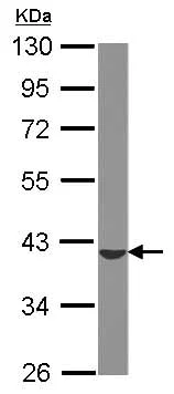 Western blot - Anti-ST6GALNAC4 antibody (AB127016)