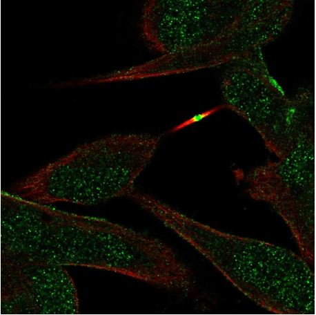 Immunocytochemistry/ Immunofluorescence - Anti-ST8SIA5 antibody (AB184777), expandable thumbnail