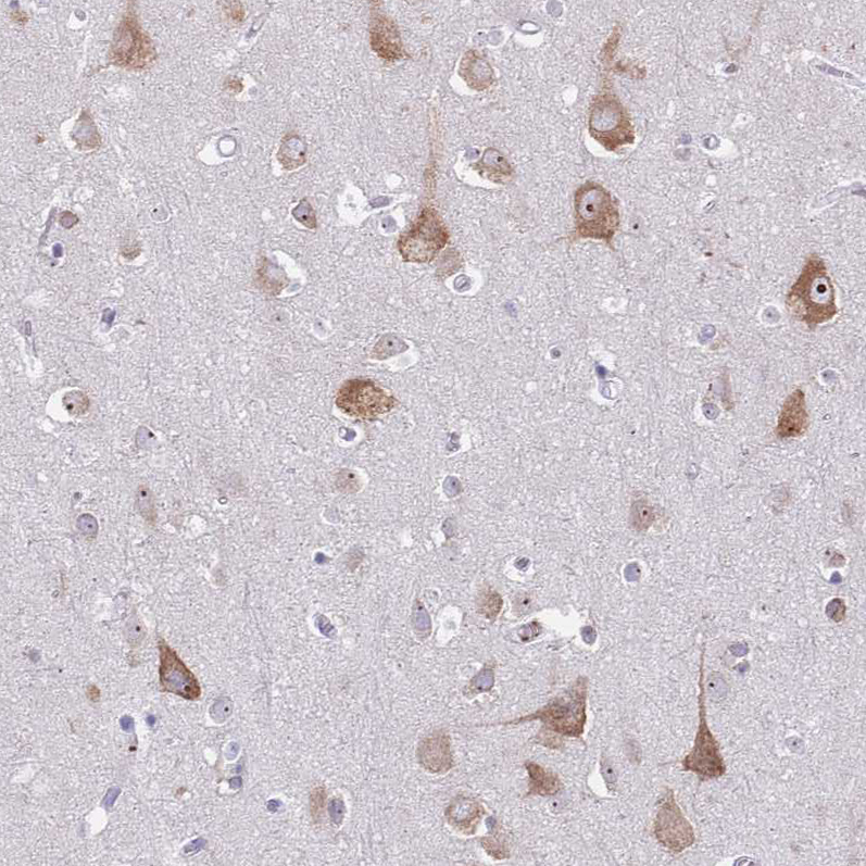 Immunohistochemistry (Formalin/PFA-fixed paraffin-embedded sections) - Anti-ST8SIA5 antibody (AB184777), expandable thumbnail