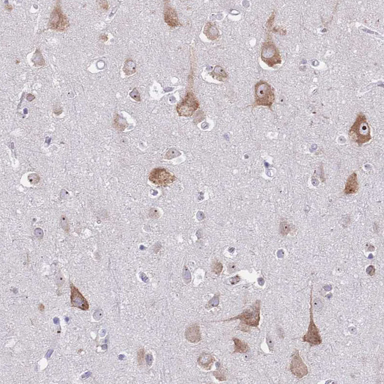 Immunohistochemistry (Formalin/PFA-fixed paraffin-embedded sections) - Anti-ST8SIA5 antibody (AB184777)