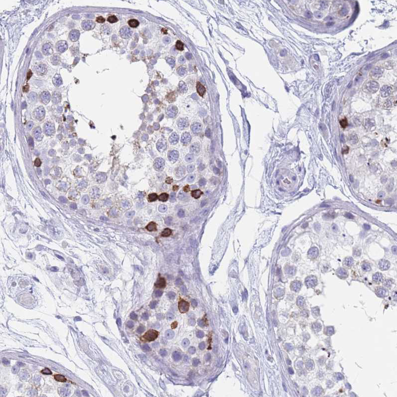 Immunohistochemistry (Formalin/PFA-fixed paraffin-embedded sections) - Anti-ST8SIA5 antibody (AB184777), expandable thumbnail