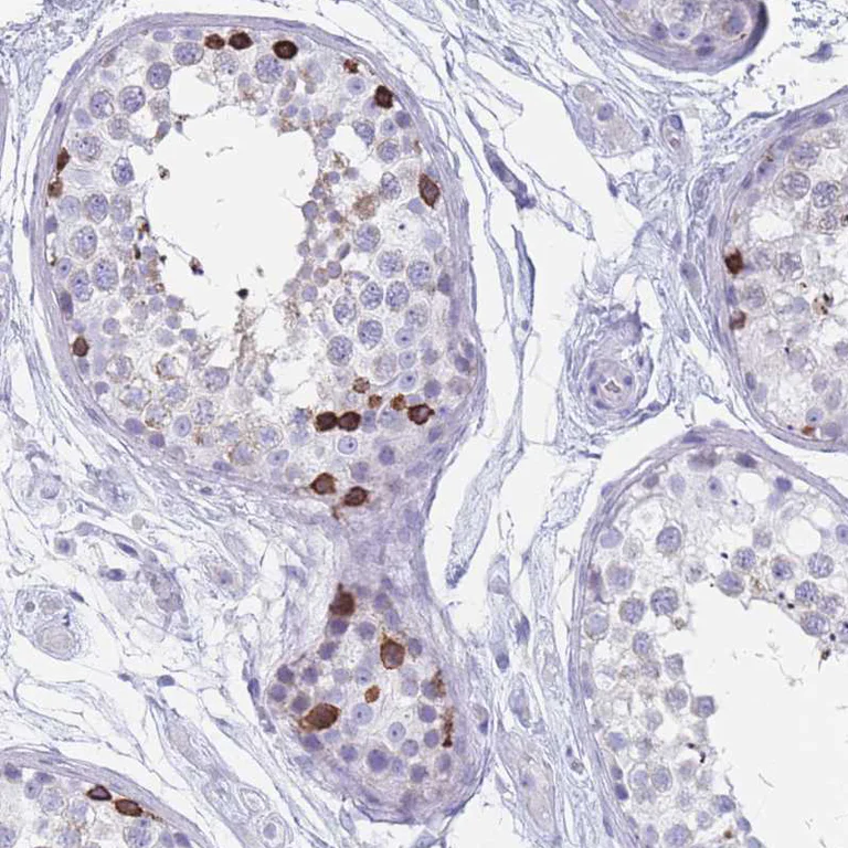 Immunohistochemistry (Formalin/PFA-fixed paraffin-embedded sections) - Anti-ST8SIA5 antibody (AB184777)