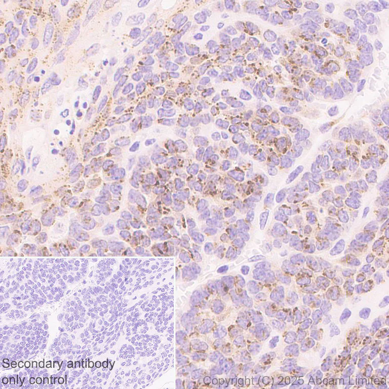 Immunohistochemistry (Formalin/PFA-fixed paraffin-embedded sections) - Anti-ST8SIA6 antibody [EPR29919-587] (AB325041)