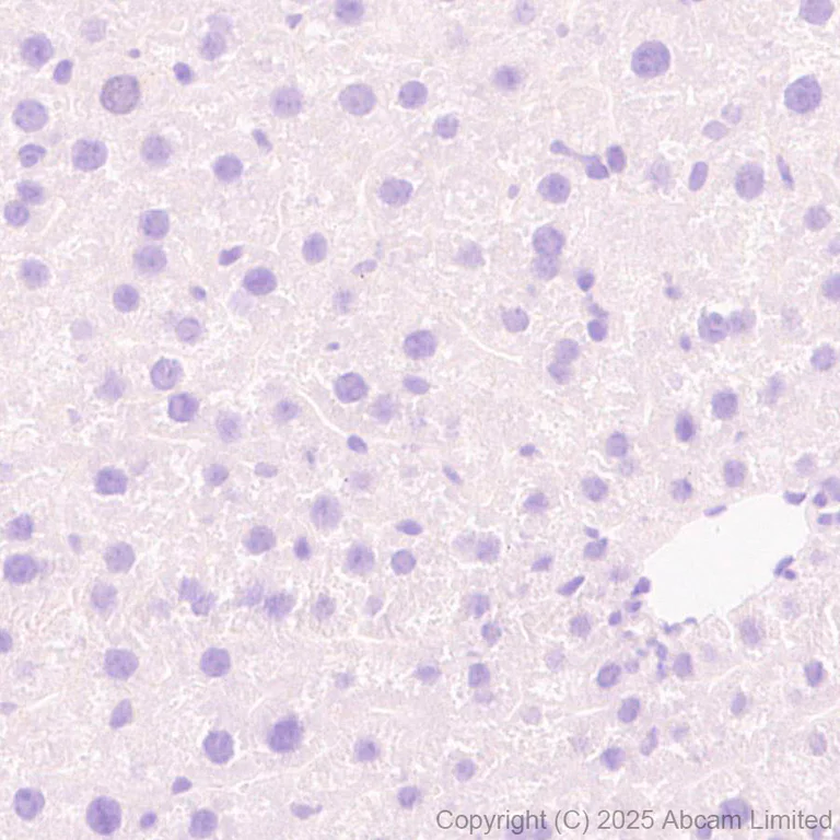 Immunohistochemistry (Formalin/PFA-fixed paraffin-embedded sections) - Anti-ST8SIA6 antibody [EPR29919-587] (AB325041)