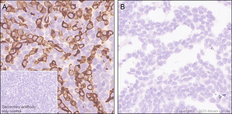 Immunohistochemistry (Formalin/PFA-fixed paraffin-embedded sections) - Anti-ST8SIA6 antibody [EPR29919-587] (AB325041)