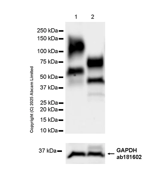 Western blot - Anti-ST8SIA6 antibody [EPR29919-587] (AB325041)