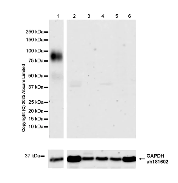 Western blot - Anti-ST8SIA6 antibody [EPR29919-587] (AB325041)