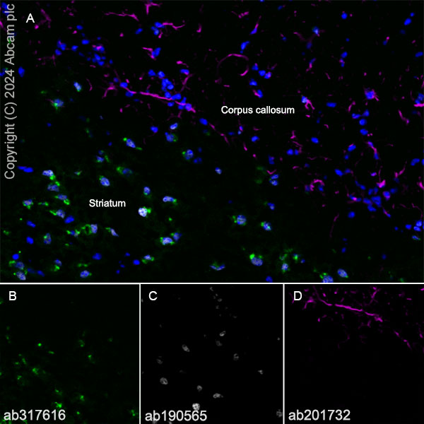Immunohistochemistry (Frozen sections) - Anti-ST8SiaIII antibody [EPR28521-92] (ab317616), expandable thumbnail