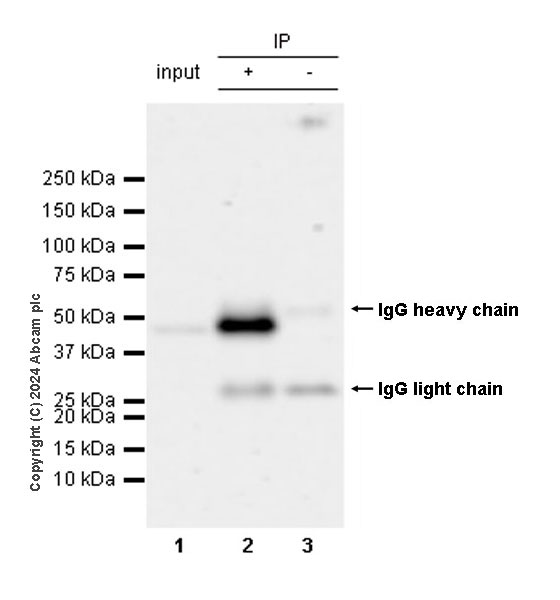 Immunoprecipitation - Anti-ST8SiaIII antibody [EPR28521-92] (AB317616), expandable thumbnail