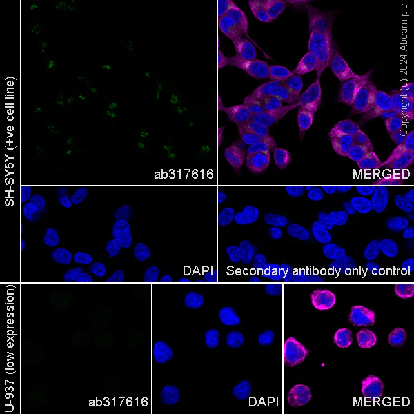 Immunocytochemistry/ Immunofluorescence - Anti-ST8SiaIII antibody [EPR28521-92] - BSA and Azide free (AB317617)