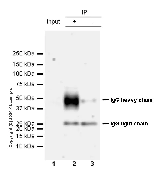 Immunoprecipitation - Anti-ST8SiaIII antibody [EPR28521-92] - BSA and Azide free (AB317617)