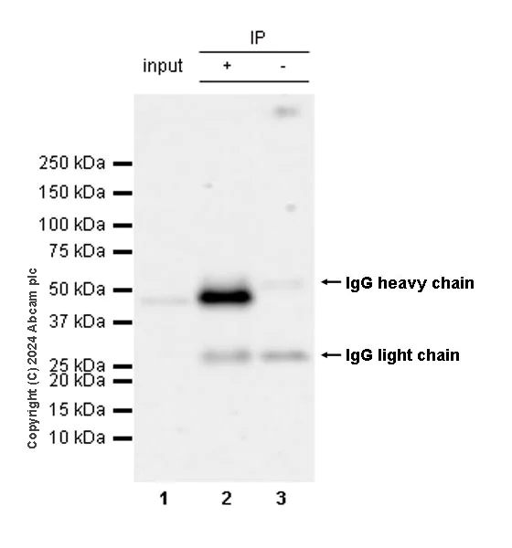 Immunoprecipitation - Anti-ST8SiaIII antibody [EPR28521-92] - BSA and Azide free (AB317617)
